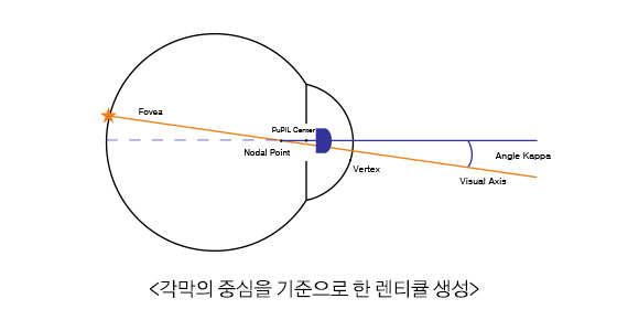 각막의 중심을 기준으로 한 렌티큘 생성
