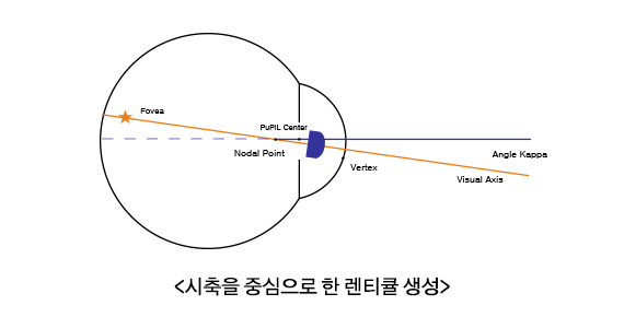 시축을 중심으로 한 렌티큘 생성