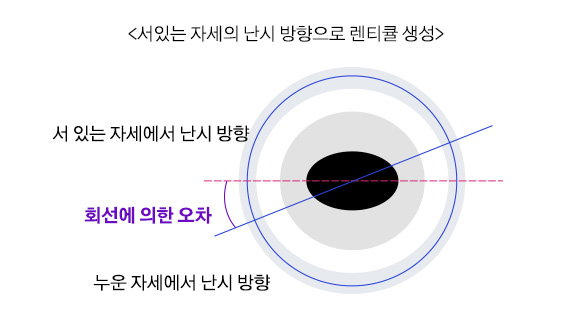서있는 자세의 난시 방향으로 렌티큘 생성