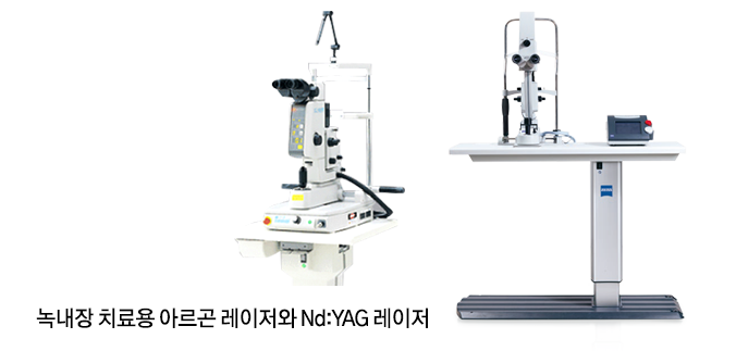 녹내장 치료용 아르곤 레이저와 Nd:YAG 레이저